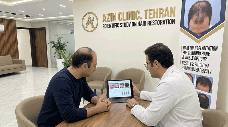 آیا کاشت مو برای افراد مو نازک امکان پذیر است