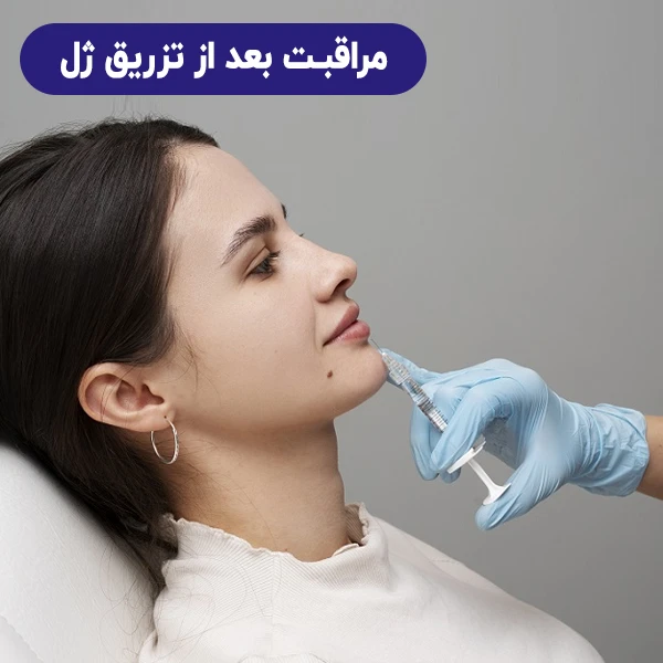 مراقبت بعد از تزریق ژل
